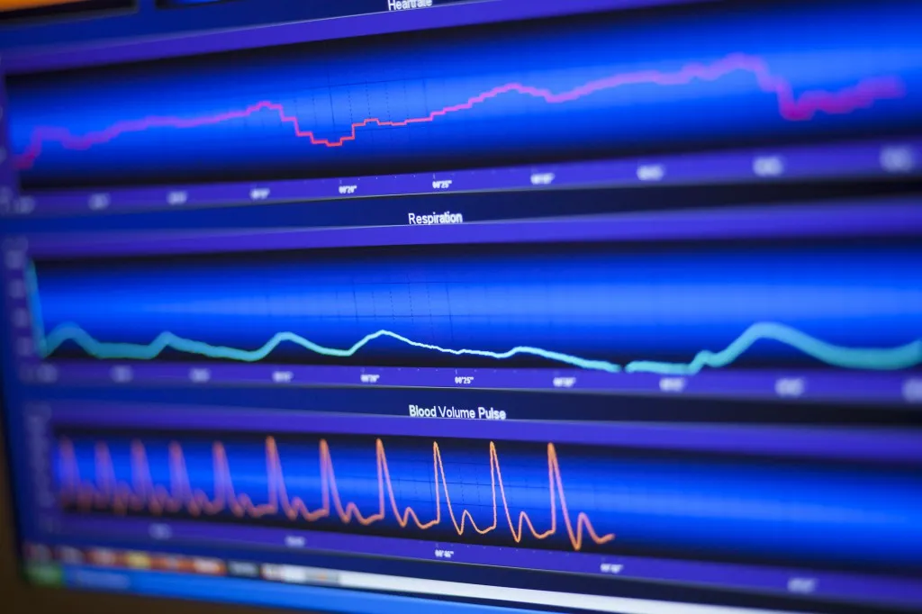 Close-up of live biofeedback traces: heart rate, respiration, and blood volume pulse